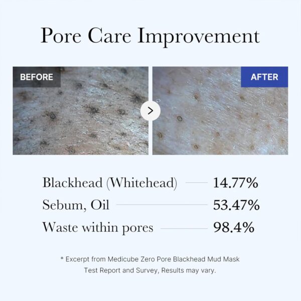 Medicube - Zero Pore Blackhead Mud Mask 100g (Made in Korea) - Image 5