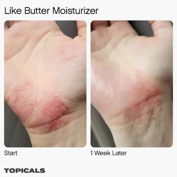 Topicals Like Butter Moisturizer for Dry, Sensitive & Eczema-Prone Skin (Made in USA) - Image 4