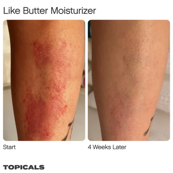 Topicals Like Butter Moisturizer for Dry, Sensitive & Eczema-Prone Skin (Made in USA) - Image 3